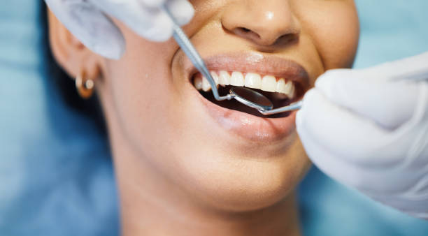 Best Emergency Wisdom Teeth Removal in Central Gardens, TX